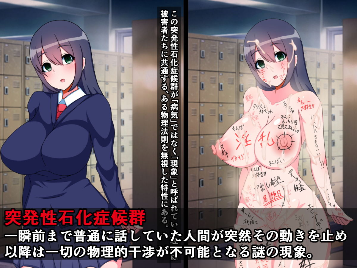突発性石化症候群（3）～石化オタクが見た被害者たち～