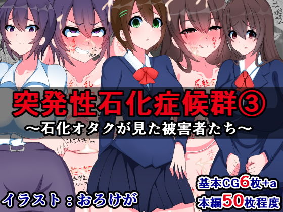 突発性石化症候群（3）～石化オタクが見た被害者たち～